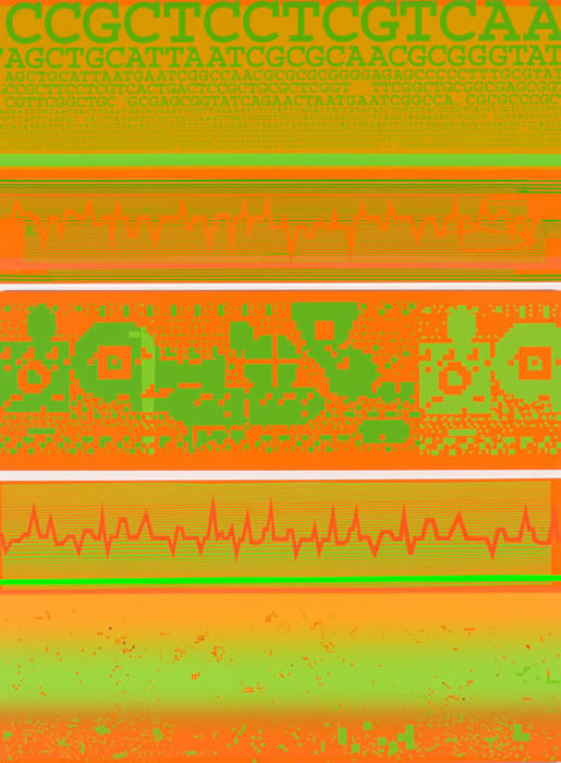 Double-ekg